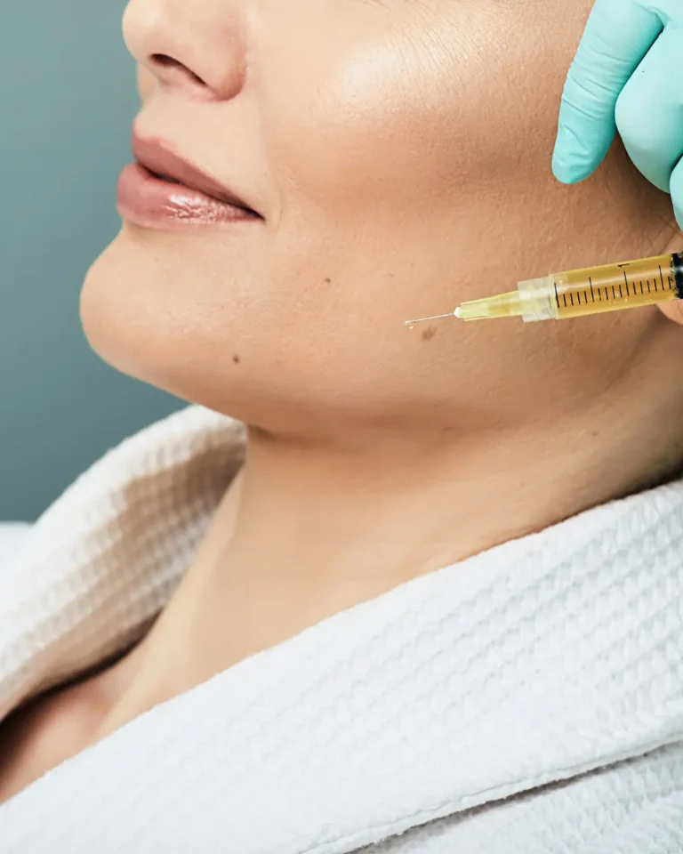 lipofilling-facial