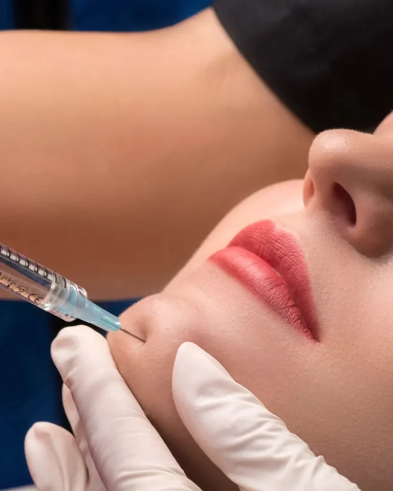 lipofilling-facial