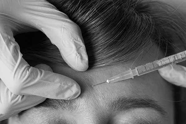 Aplicación de toxina botulínica